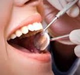 Плохой уход за зубами может привести к болезни  Альцгеймера
