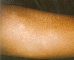 белые пятна на тебе у ребенка