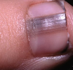 Что ваши ногти могут рассказать о вашем здоровье?