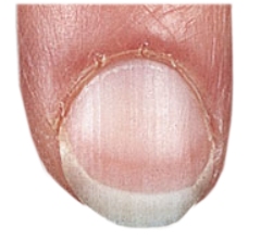 Бледные ногти