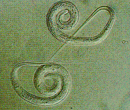 Дракункулез