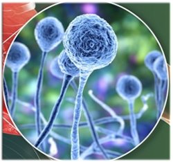 Мукормикоз (чёрный грибок)