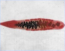 Описторхоз