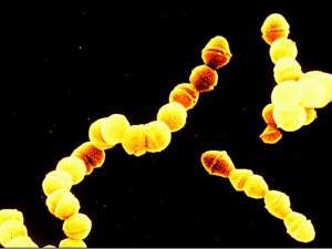 паразиты в мозгу 