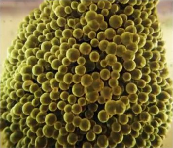 Микроб красивый, но опасный