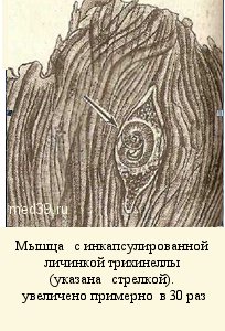 Трихинеллы