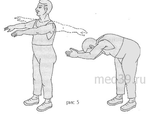 лечебная физкультура после инфаркта