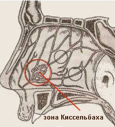 Носовые кровотечения