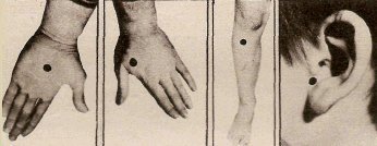 Точечный массаж при раздражительности