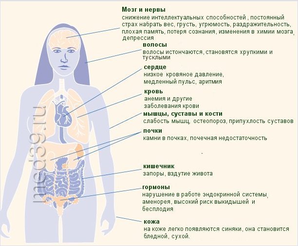 Анорексия