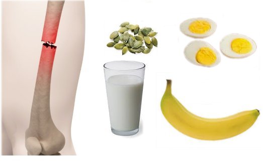 еда после перелома