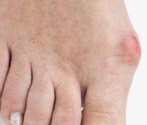 Причины боли в большом пальце ноги