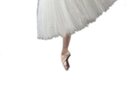 Сесамоидит большого пальца стопы