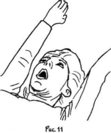 Укрепление мышц щек