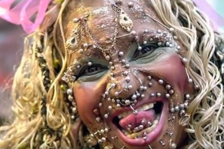 Осложнения после пирсинга - келоидные рубцы.