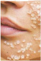 Зачем скрабы для лица