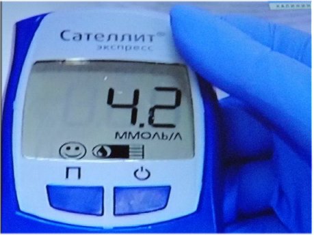 Глюкоза в крови
