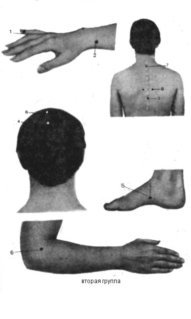 Точечный массаж при атеросклерозе