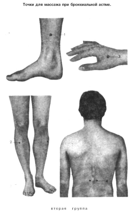 Точечный массаж при бронхиальной астме