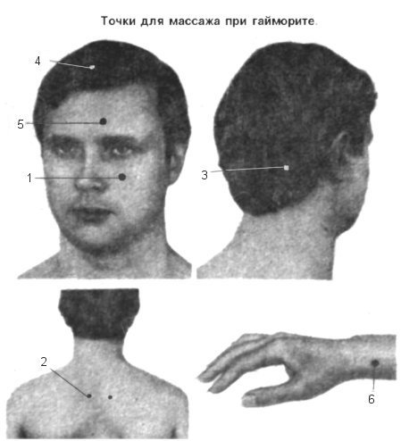 Точечный массаж при гайморите