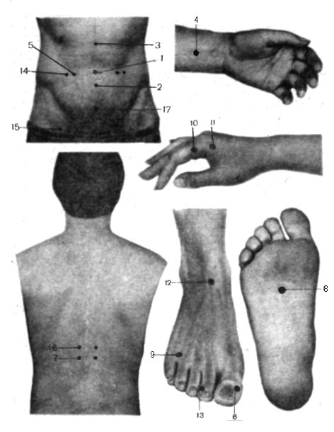 Точечный массаж при газах в животе