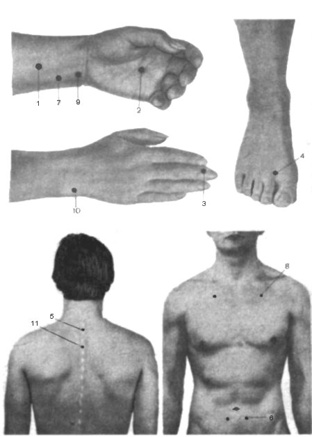 Точечный массаж при повышенной раздражительности