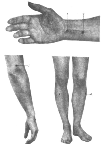 Точечный массаж при заикании