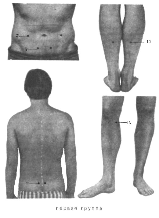 Точечный массаж при запоре