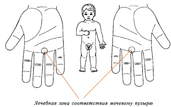 энурез 
у ребенка