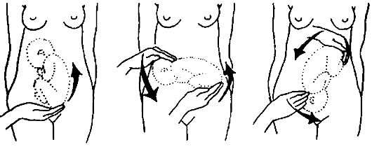 наружный поворот плода