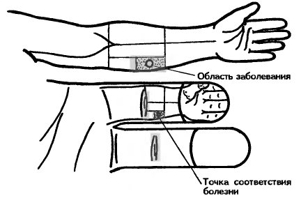 Определение точки для стимулирования