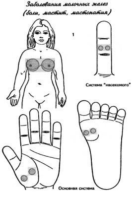 су-джок заболевания молочных желез