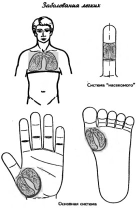 су-джок заболевания лёгких