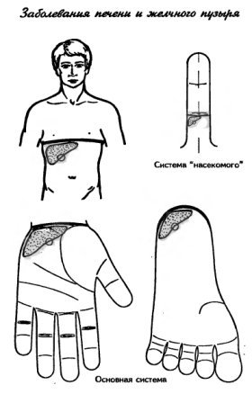 су-джок заболевания печени