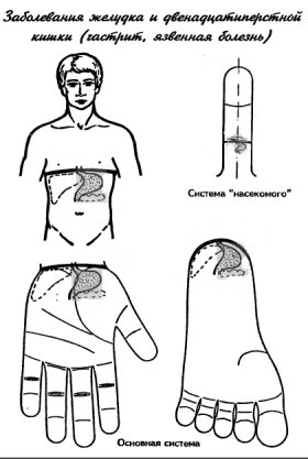 су-джок заболевания поджелудочной железы