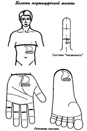 су-джок терапия