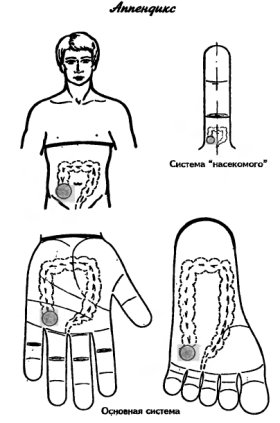 су-джок аппендицит