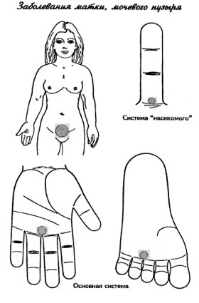 су-джок терапия