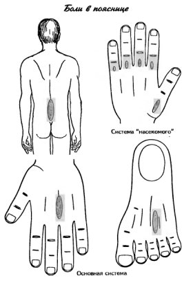 су-джок боль в пояснице