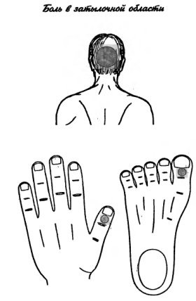 су-джок Бболь в затылочной области головы