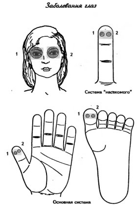 су-джок заболевания глаз