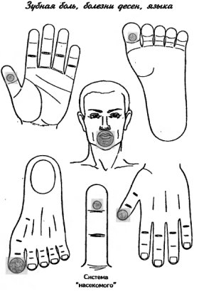 су-джок зубная боль