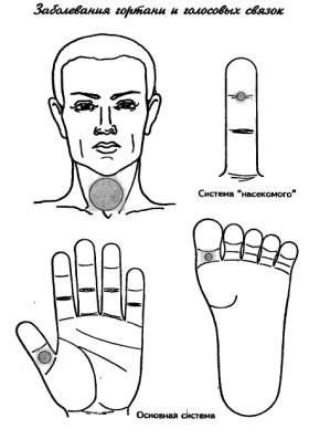 су-джок заболевания горла