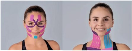 тейпирование лица в Калининграде