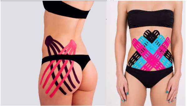 тейпирование тела в Калининграде