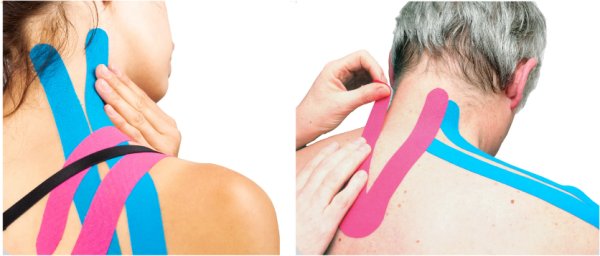 терапевтическое тейпирование тела в Калининграде